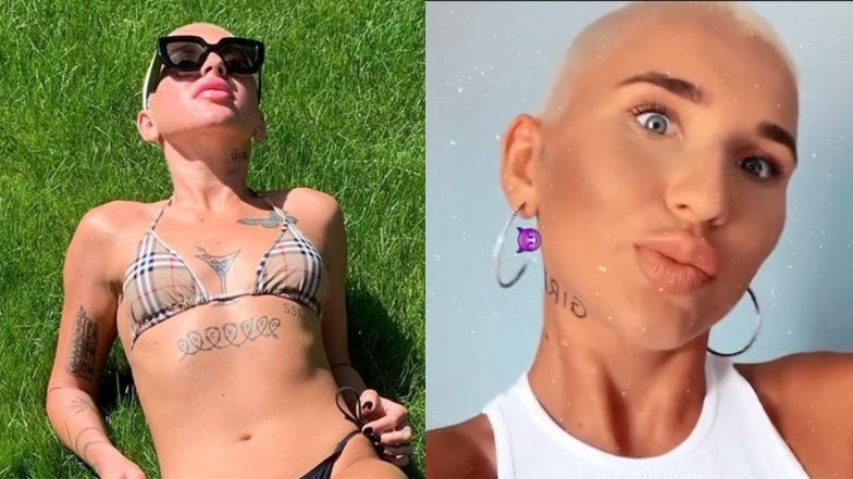 Marta Linkiewicz z ogoloną głową łapie promienie słoneczne