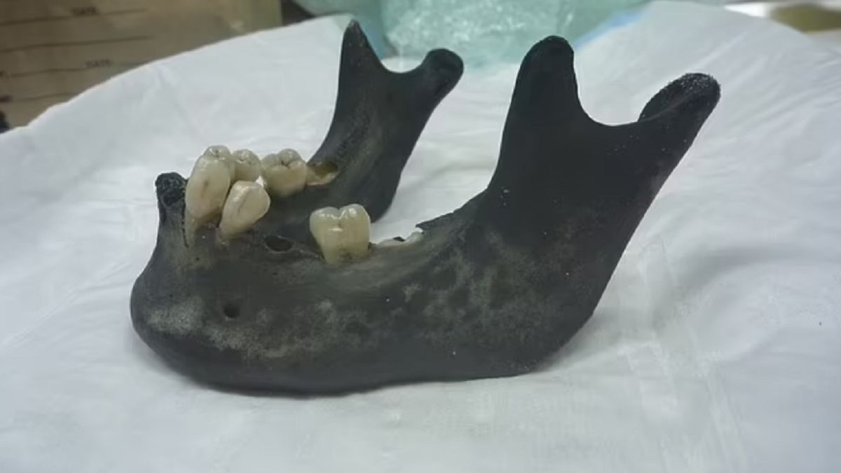 Kości znalezione na plaży mogą pochodzić sprzed 90 lat.