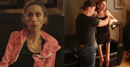 Anorektyczka prosi o pomoc: "WAŻĘ 20 KILO i żaden szpital nie chce mnie przyjąć!"