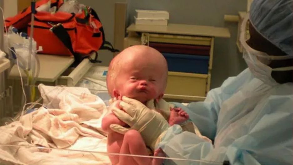 Nie dawano mu szans. Tak wygląda 16 lat później