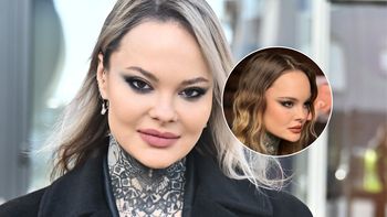 Monika Miller poprawiła sobie twarz. Pokazała się po zabiegu "tygrysiego liftingu" [ZDJĘCIA]