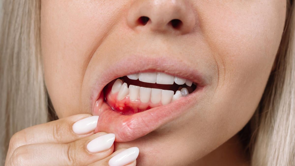 Znak ostrzegawczy raka krwi. Nigdy nie lekceważ