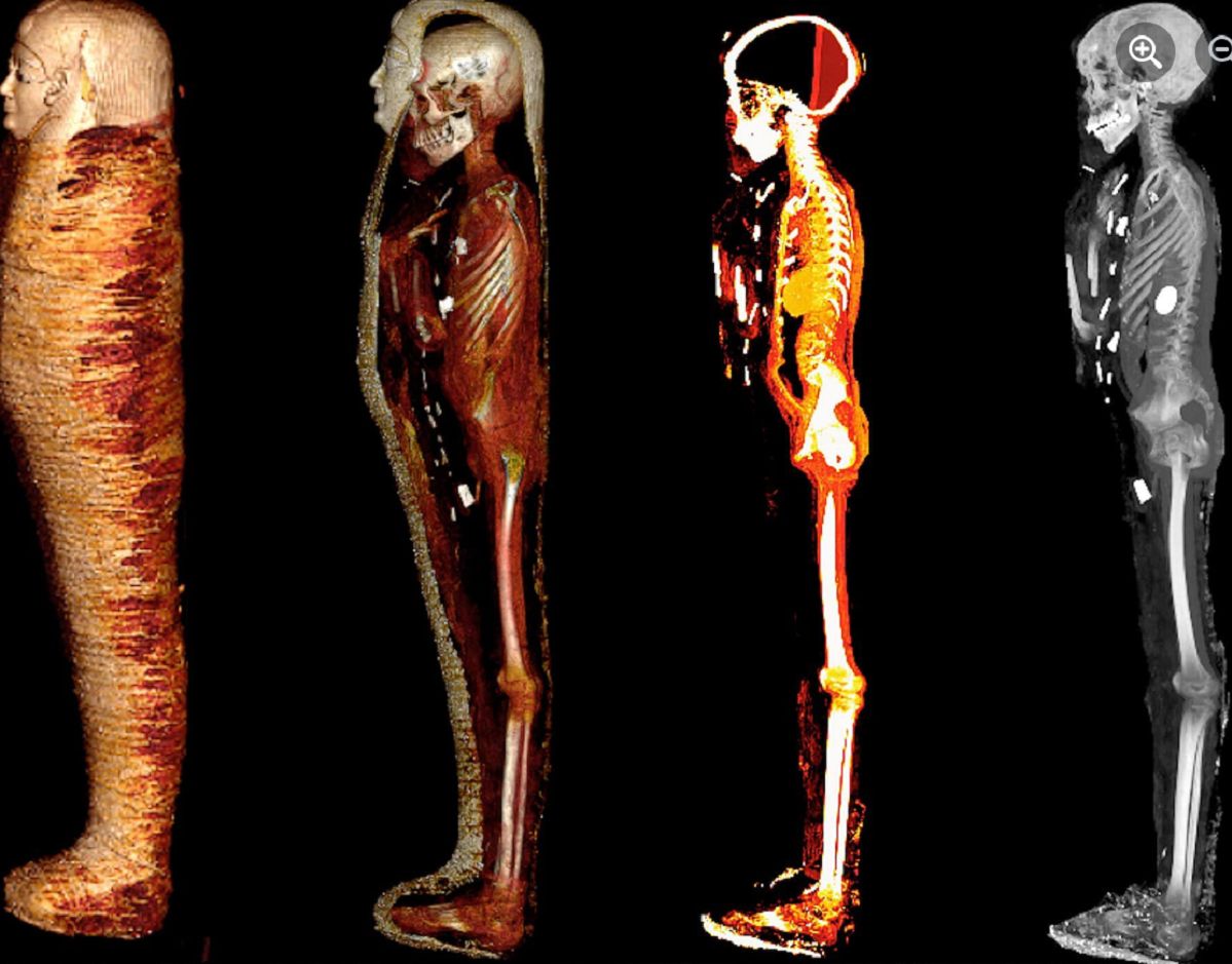 Teenage boy mummy with golden mask and 49 amulets baffles scientists - was he a foreign elite?