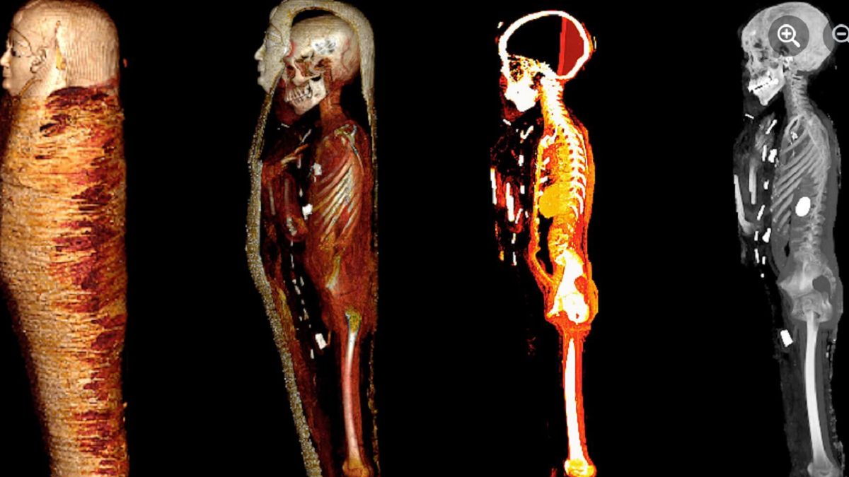 Zbadano tajemniczą mumię. 
