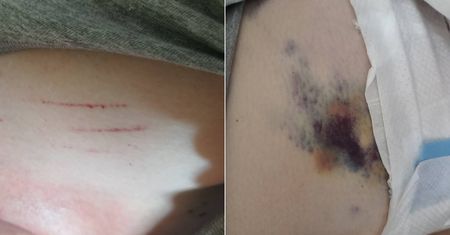 Koszmarne zaniedbania na oddziale Alergologii i Chorób Płuc? „Przeżyliśmy piekło”. Szpital dementuje