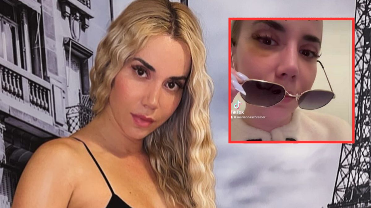 Marianna Schreiber zoperowała powieki