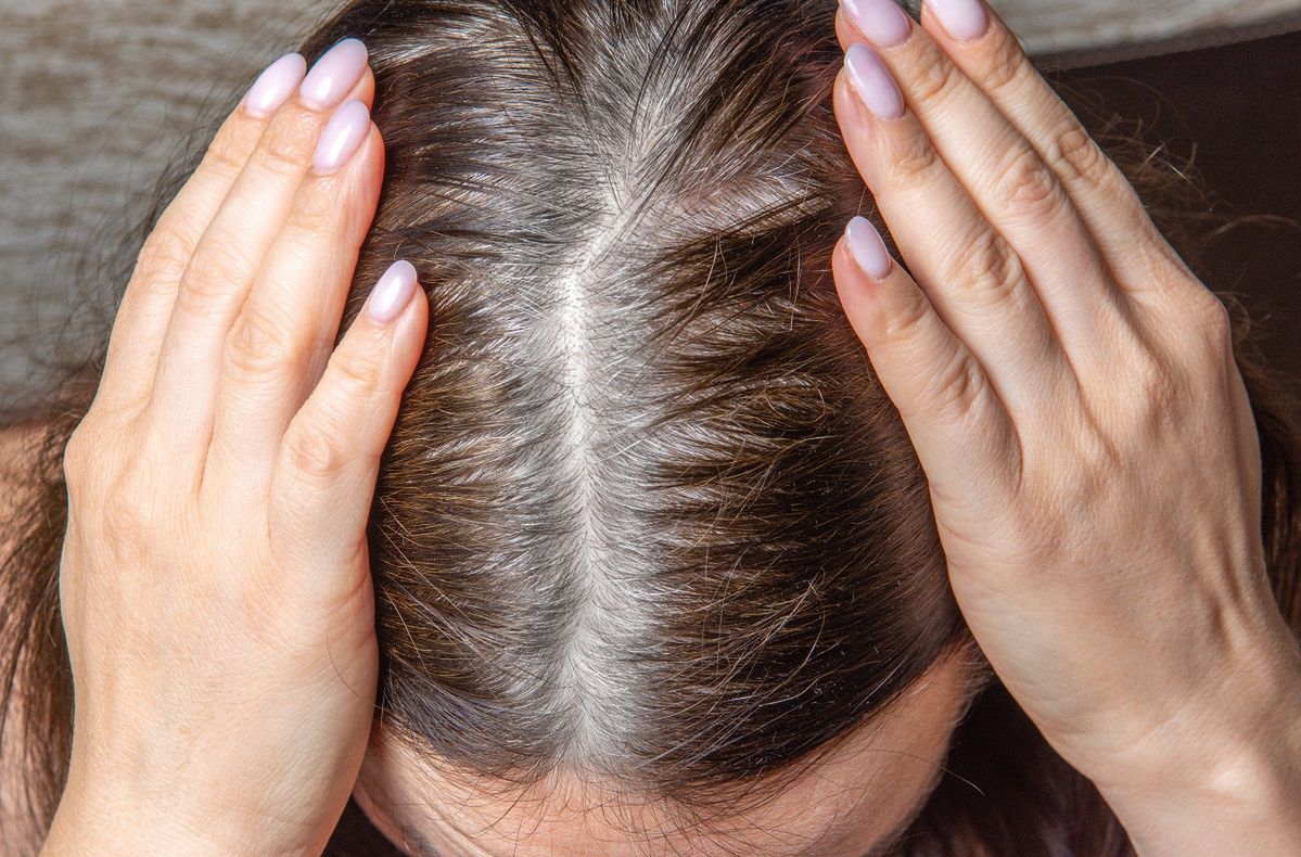 Natural solutions to hide gray hair at home