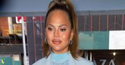 Chrissy Teigen otwarcie mówi o operacjach plastycznych. Gwiazda zapozowała z opuchniętymi ustami