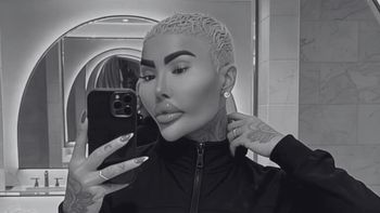 34-letni gwiazdor reality show nie żyje. Tuż przed śmiercią miał poddać się kolejnemu liftingowi pośladków