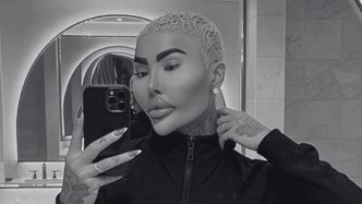 34-letni gwiazdor reality show nie żyje. Tuż przed śmiercią miał poddać się kolejnemu liftingowi pośladków