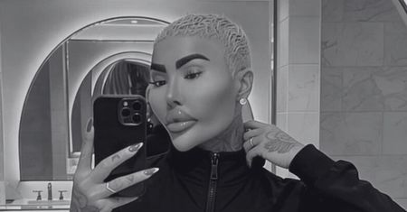 34-letni gwiazdor reality show nie żyje. Tuż przed śmiercią miał poddać się kolejnemu liftingowi pośladków