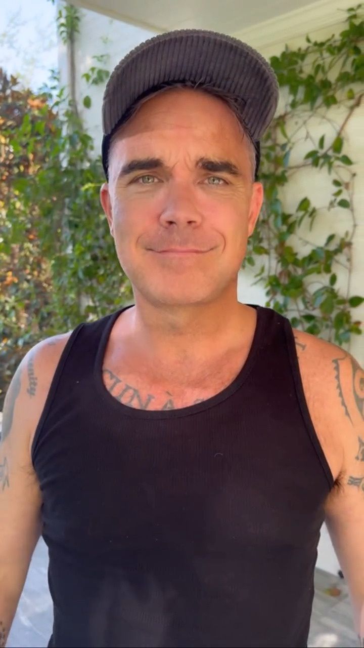 Robbie Williams revealed new teeth.