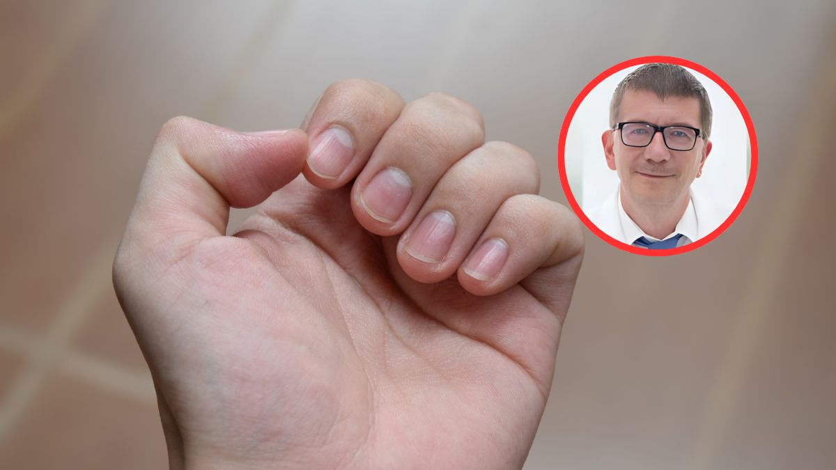 Czerniak nie zawsze pojawia się tam, gdzie świeci słońce