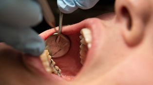 "Upokarzające". Dentystka zniszczyła jej zęby. Tyle przyznał sąd