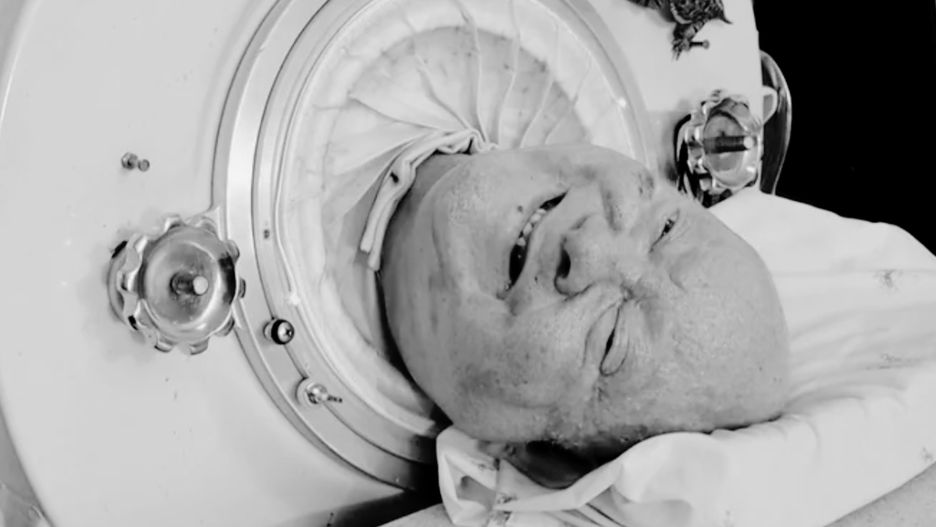 Paul Alexander nie żyje