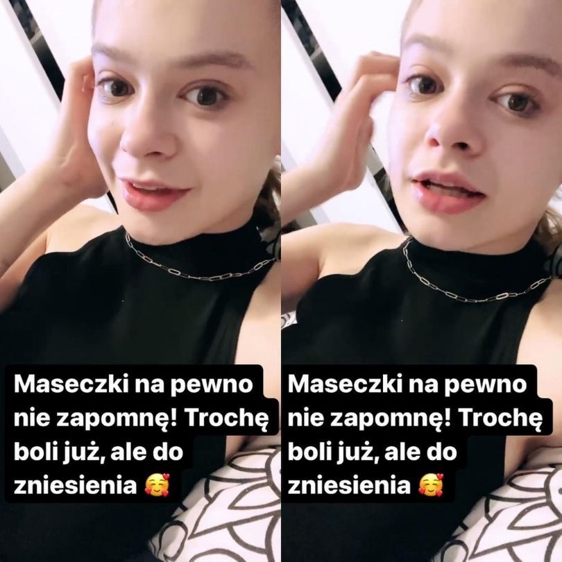 Julia Wróblewska aktualizuje stan powiększonych ust