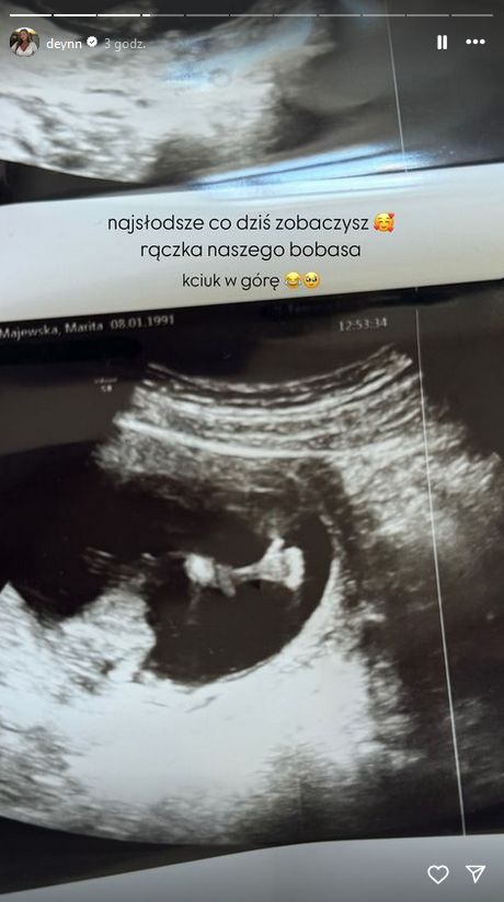 Deynn pokazała zdjęcia USG i test ciążowy