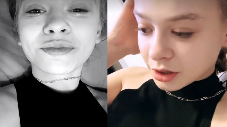 Julia Wróblewska powiększyła sobie usta