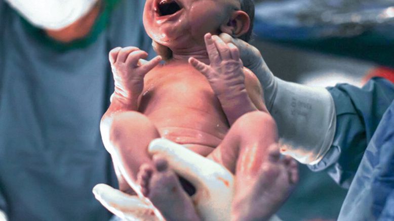 Dziecko urodziło się z bardzo rzadką wadą wrodzoną