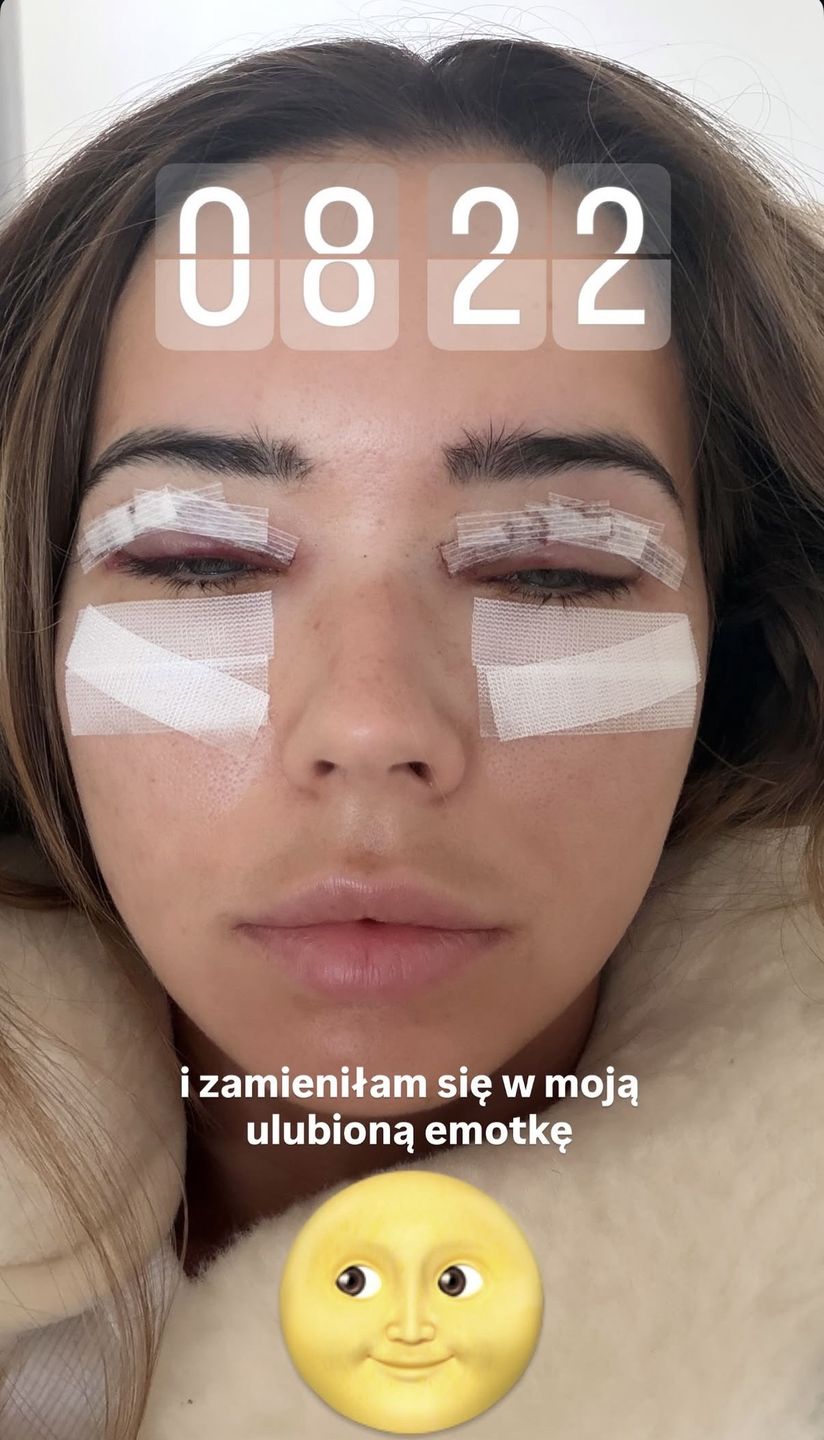 Sandra Kubicka po operacji