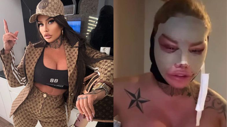 Laluna Unique pokazała się tuż po kolejnej operacji plastycznej