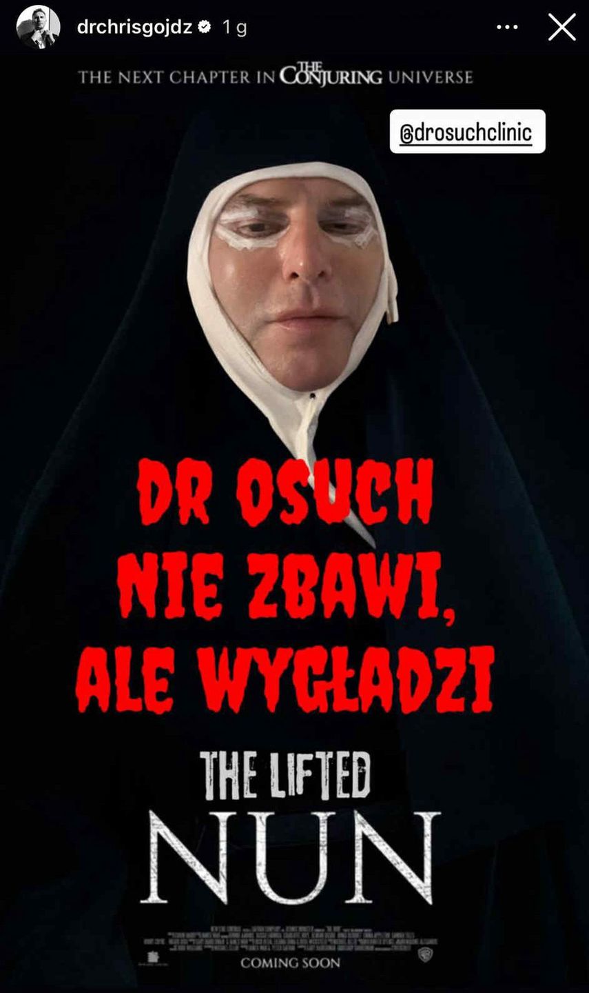 Krzysztof Gojdź śmieszkuje pierwszej nocy po liftingu