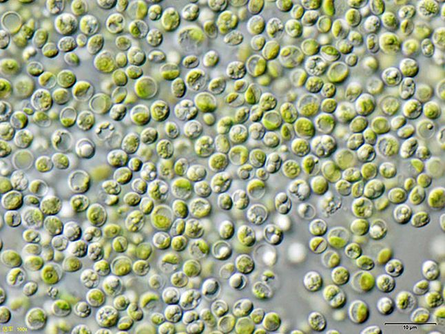Algi pod mikroskopem.