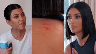 Poturbowana przez siostrę Kim Kardashian prezentuje RANY na ciele. Kourtney odejdzie z programu?! "NIE CHCĘ BYĆ OBOK TWOJEJ GRUBEJ D*PY" (WIDEO)