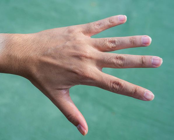 Poprzeczne paski na płytce paznokci mogą świadczyć o chorobach nerek lub wątroby