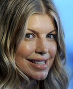 Fergie - co się stało z jej twarzą?