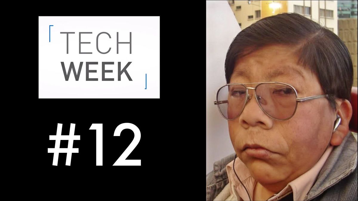 Tech Week #12: Apple Watch, wysypka i chińska maszyna do pobierania spermy 1
