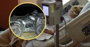 Siostry jechały quadem. Podróż skończyły w szpitalu