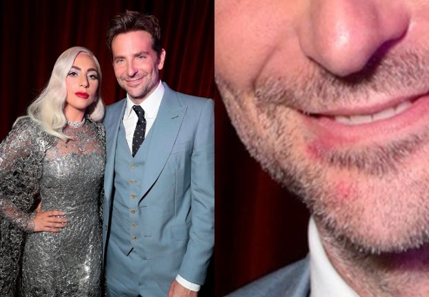 Lady Gaga i Bradley Cooper jednak MAJĄ ROMANS? Fani dopatrzyli się śladów jej szminki na jego twarzy... (FOTO)