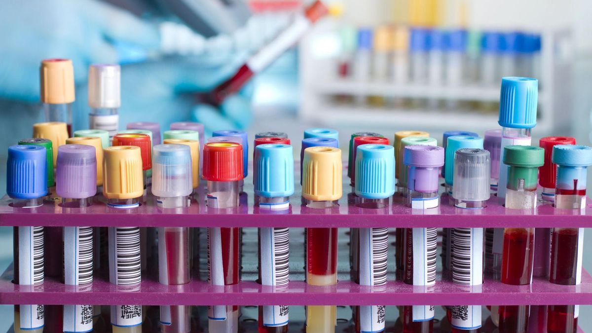 Krew warto oczyszczać naturalnymi sposobami