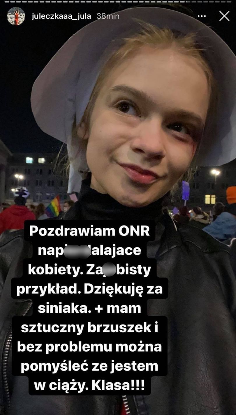 Julia Wróblewska pobita podczas manifestacji w Warszawie!