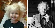 Dziecko z włosami niczym Albert Einstein – żart rodziców czy nietypowa choroba?