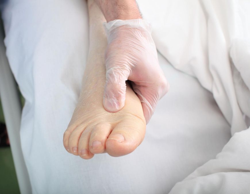 Obrzęk stóp może być skutkiem choroby nerek