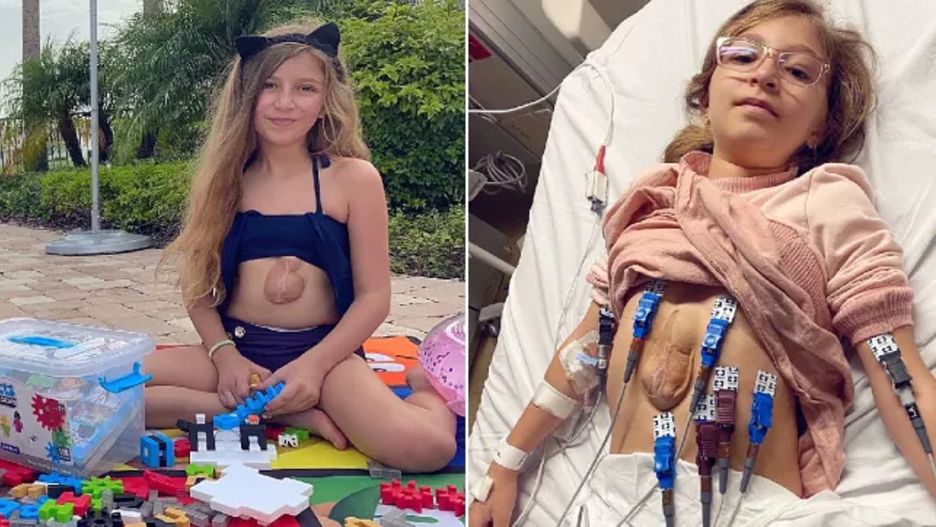 Urodziła się z sercem na wierzchu