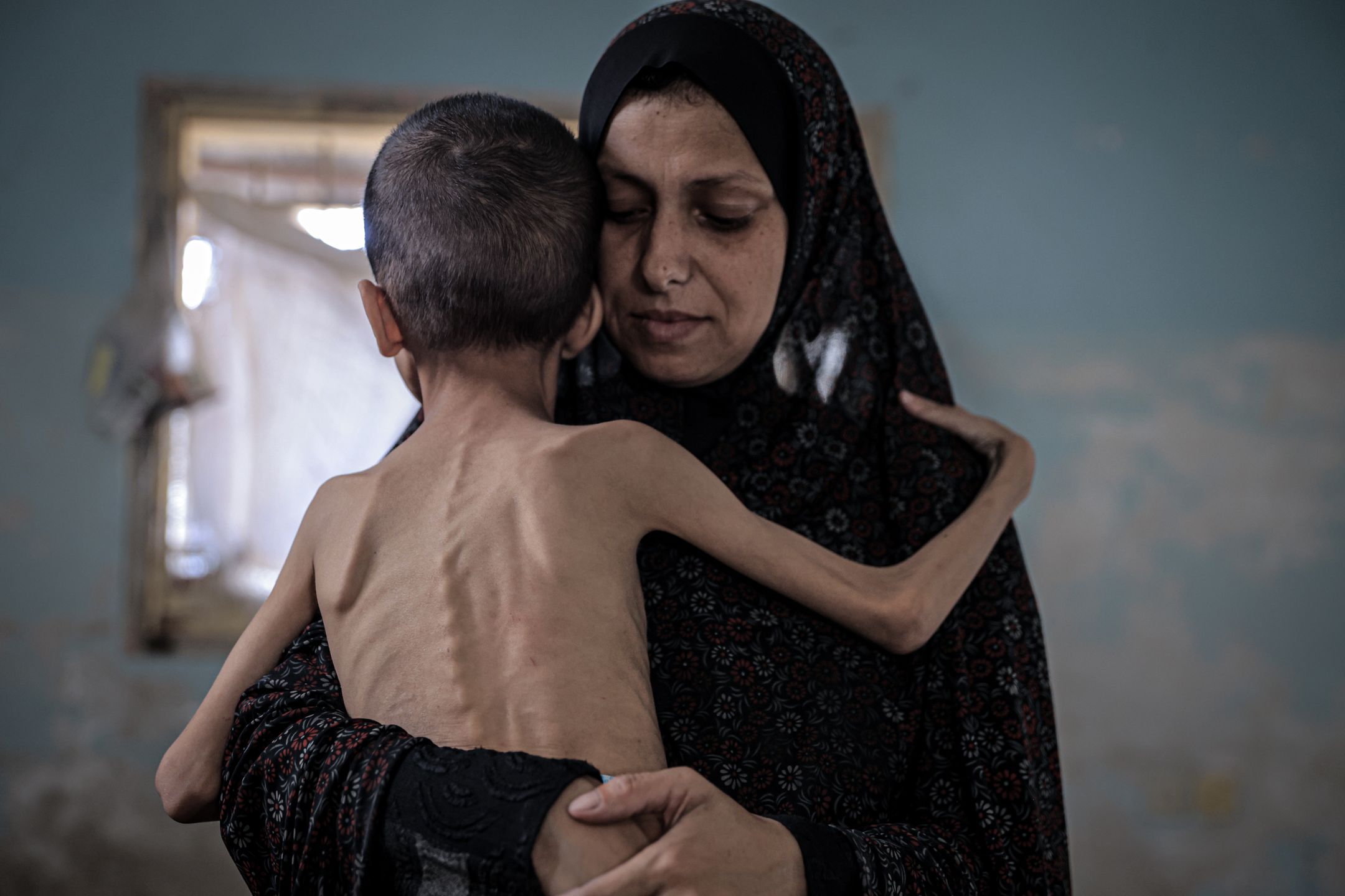 Głód w Strefie Gazy