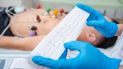 Kardiomiopatia rozstrzeniowa - przyczyny, objawy i leczenie