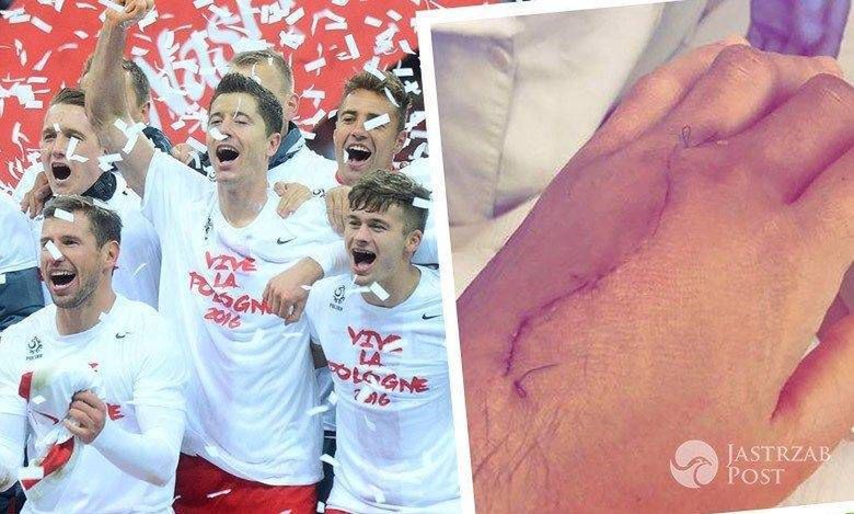 Groźny wypadek piłkarza reprezentacji Polski. Jest przerażające wideo i zdjęcia ze szpitala