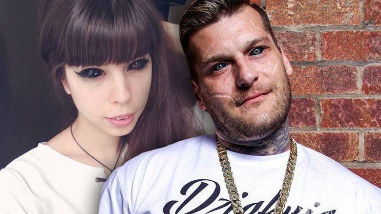 Anoxi Cime, fanka Popka, straciła wzrok