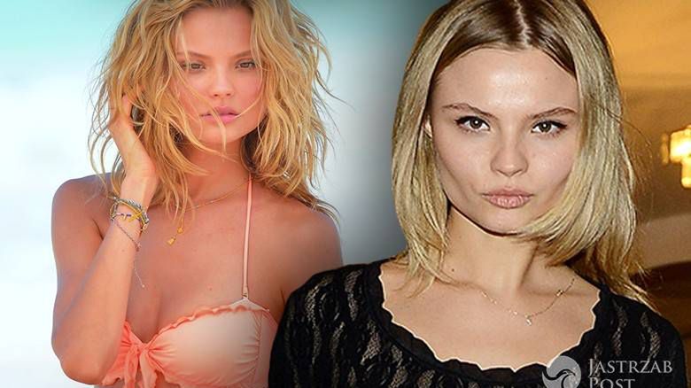 Magdalena Frąckowiak pokazała zdjęcia obrażeń po pobiciu