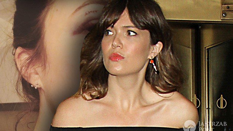 Mandy Moore miała nieszczęśliwy wypadek