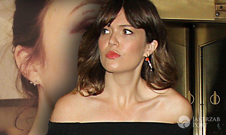 Mandy Moore miała nieszczęśliwy wypadek