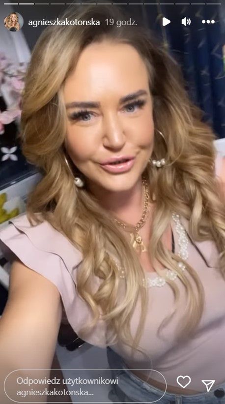 Agnieszka Kotońska pokazała twarz po zabiegu