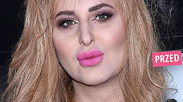 Rafalala metamorfoza