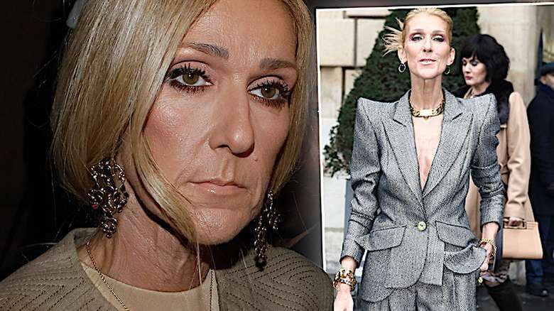 Celine Dion anoreksja