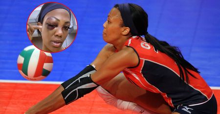 Te obrazki mrożą krew. Medalistka olimpijska brutalnie zaatakowana
