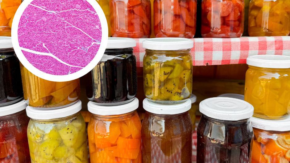 W ten sposób nieświadomie rujnujesz swoją trzustkę. 6 najgorszych produktów